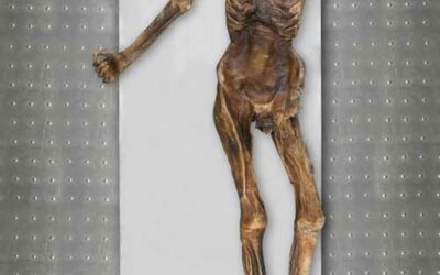 Ötzi – total body